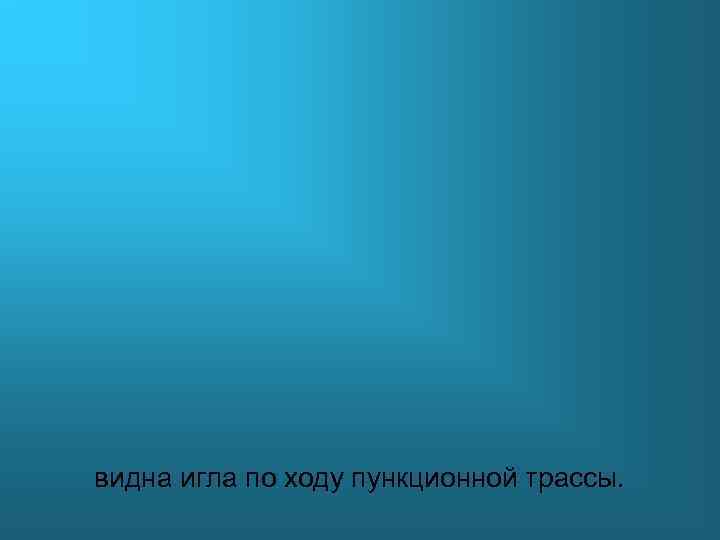 видна игла по ходу пункционной трассы. 