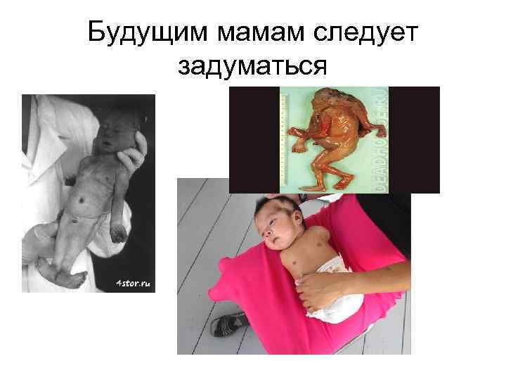 Будущим мамам следует задуматься 