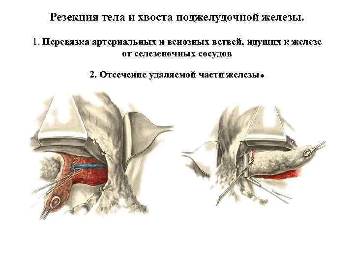 Закрытая травма живота карта вызова