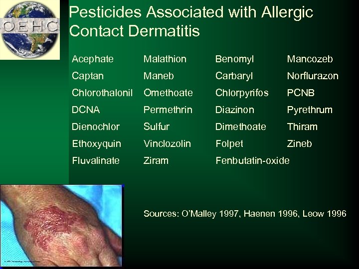 Pesticides Associated with Allergic Contact Dermatitis Acephate Malathion Benomyl Mancozeb Captan Maneb Carbaryl Norflurazon
