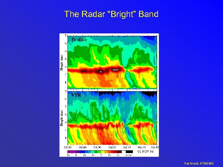 The Radar “Bright” Band Pat Arnott, ATMS 360 