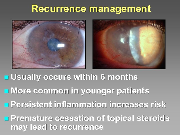 Recurrence management n Usually n More occurs within 6 months common in younger patients
