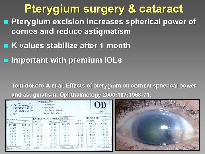 Pterygium surgery & cataract n Pterygium excision increases spherical power of cornea and reduce