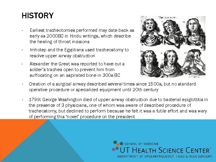 HISTORY - Earliest tracheotomies performed may date back as early as 2000 BC in