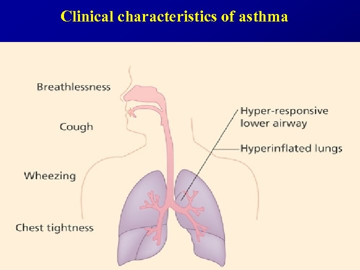 Clinical characteristics of asthma 