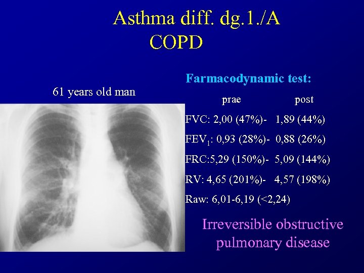 Asthma diff. dg. 1. /A COPD 61 years old man Farmacodynamic test: prae post