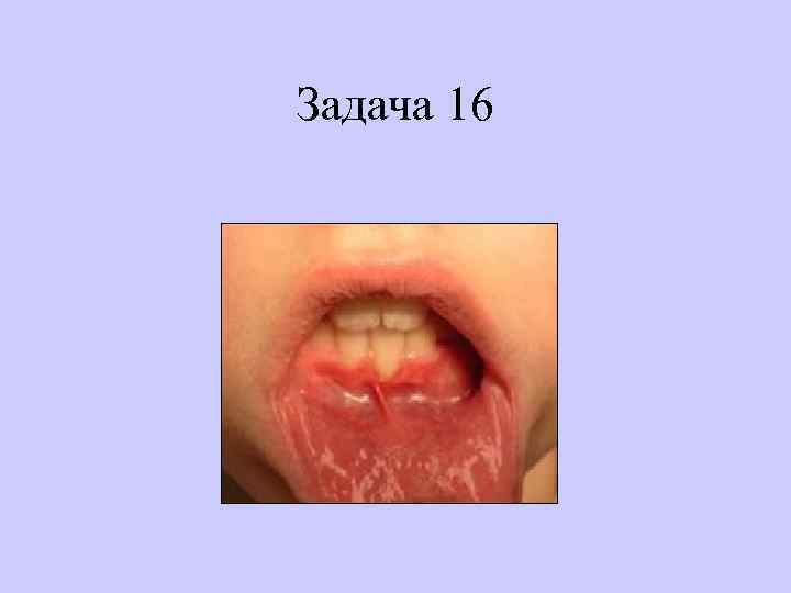 Задача 16 