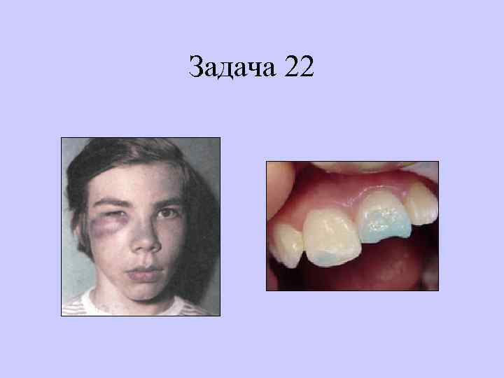 Задача 22 