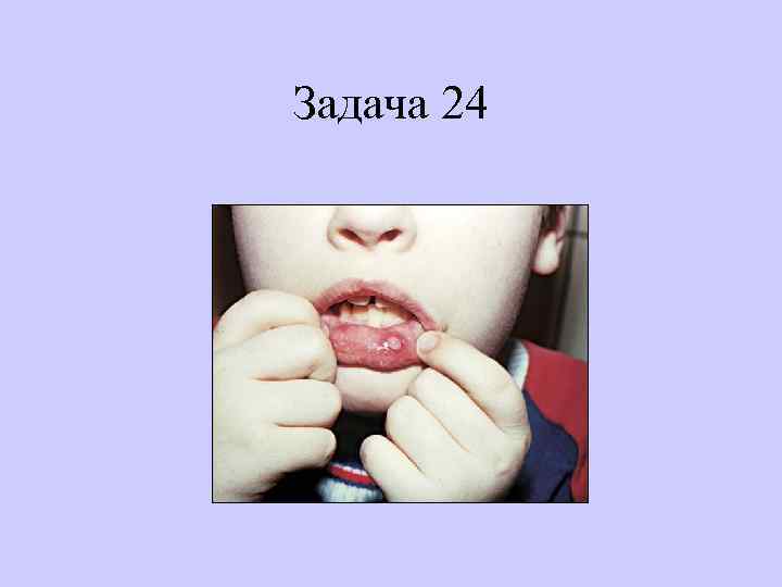 Задача 24 