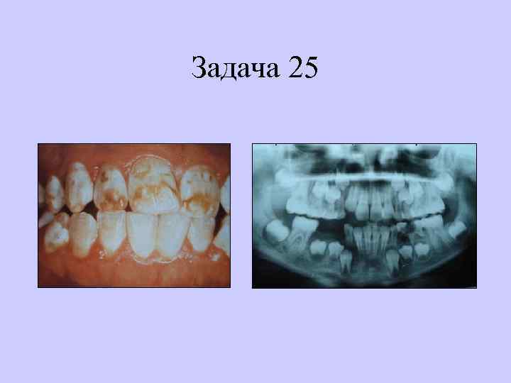 Задача 25 