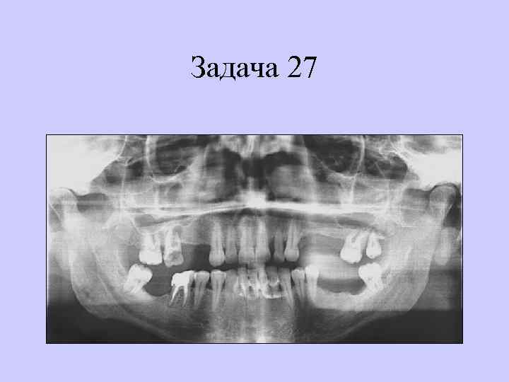 Задача 27 