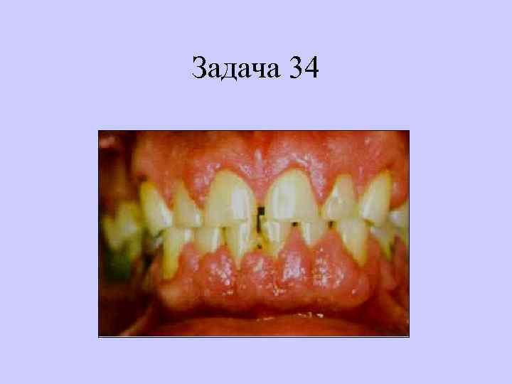 Задача 34 