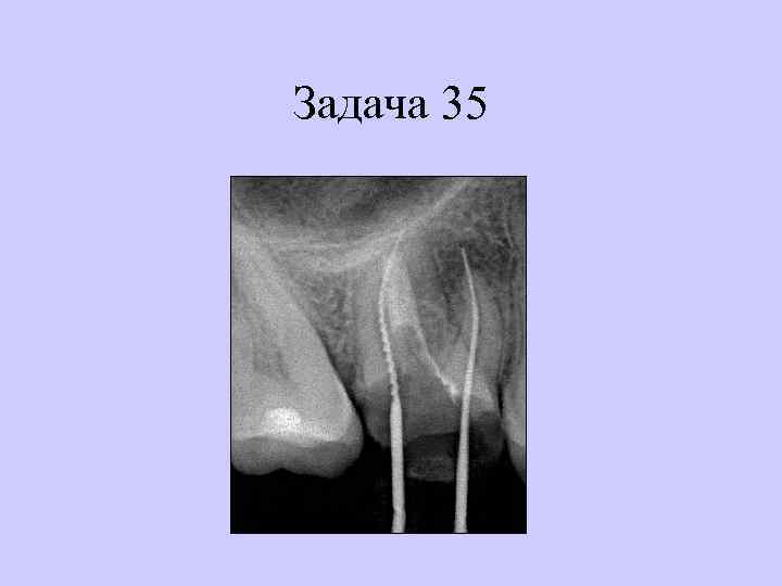 Задача 35 