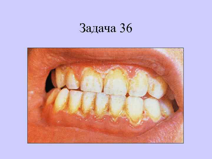 Задача 36 