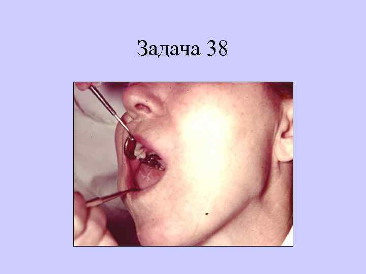 Задача 38 