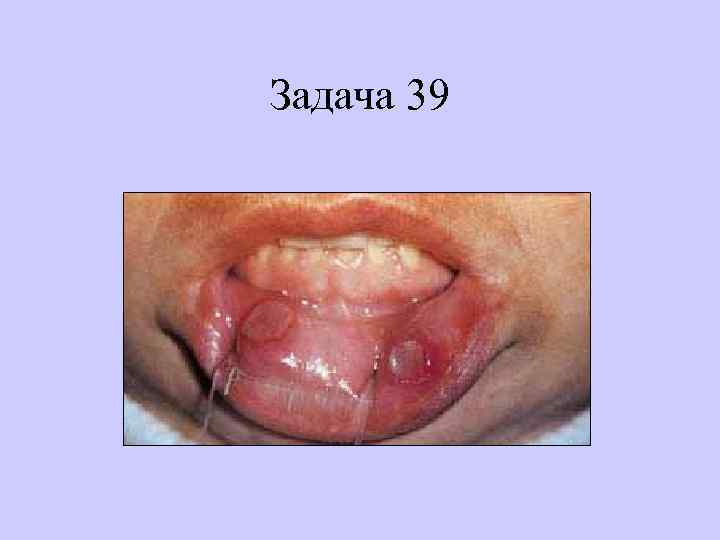 Задача 39 