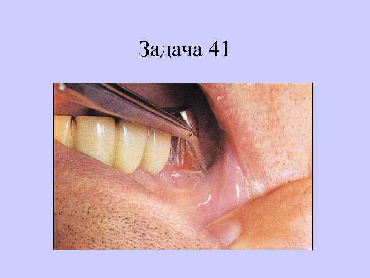 Задача 41 