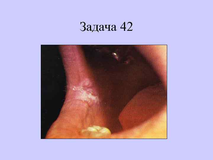 Задача 42 