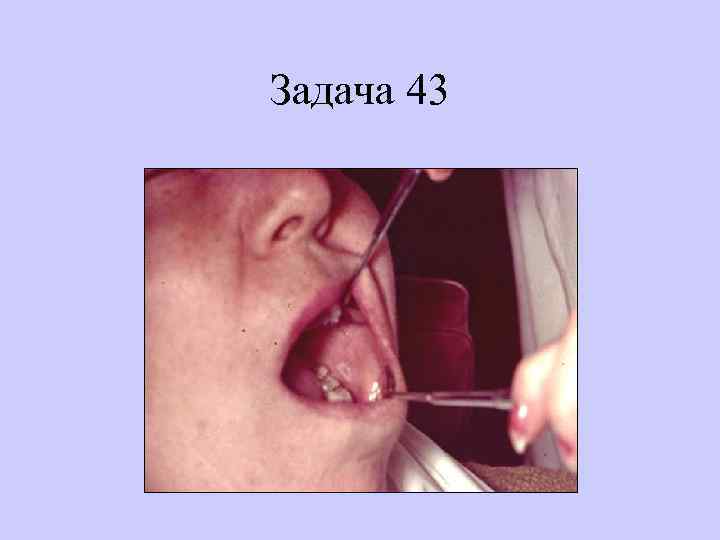 Задача 43 
