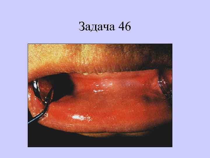 Задача 46 