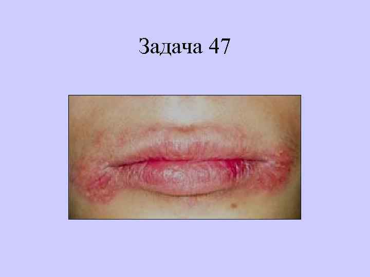 Задача 47 