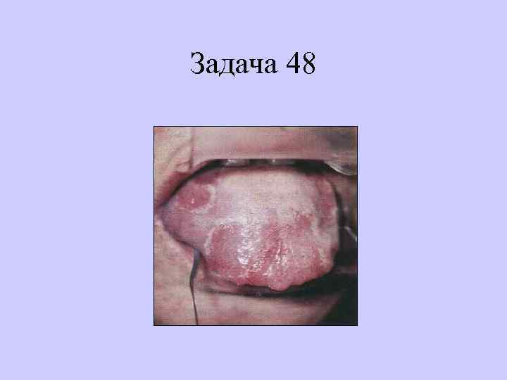 Задача 48 