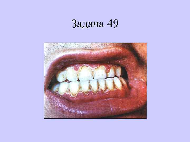 Задача 49 