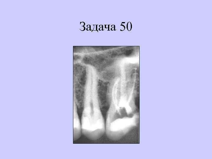 Задача 50 