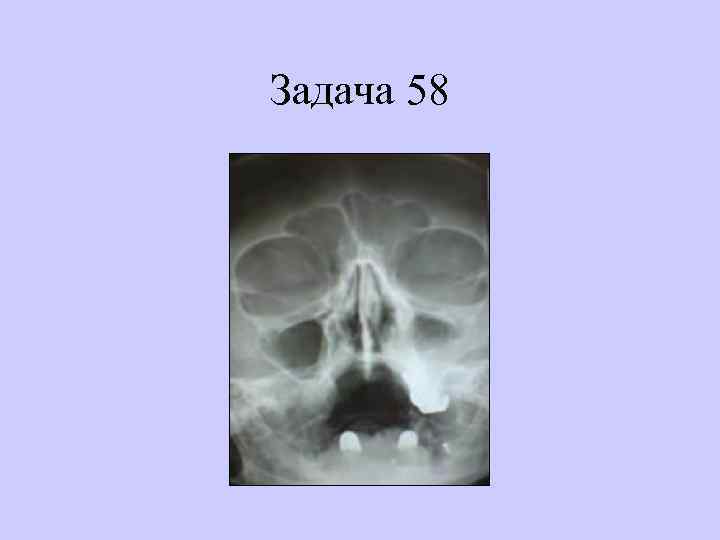 Задача 58 