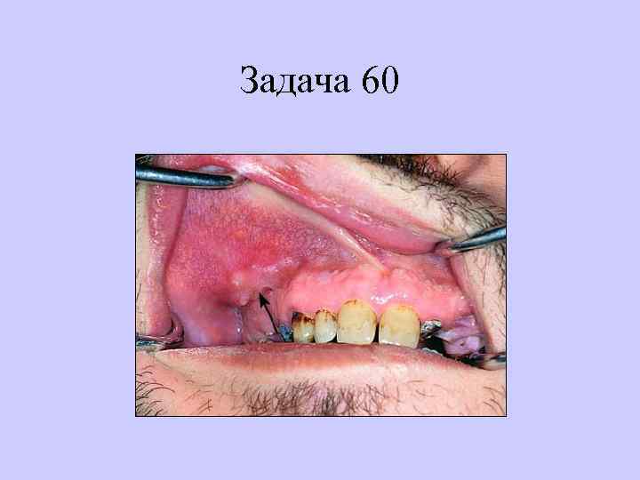 Задача 60 