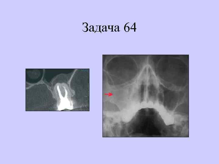 Задача 64 