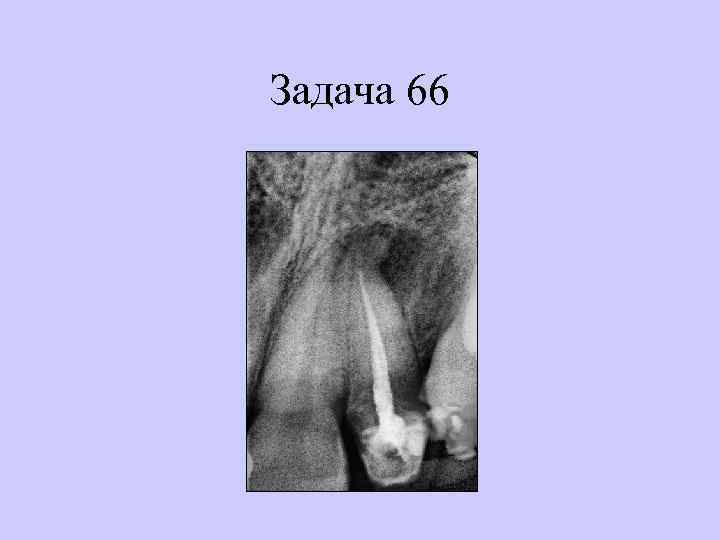 Задача 66 