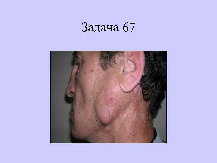 Задача 67 