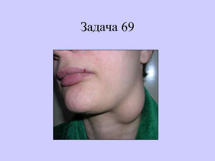 Задача 69 