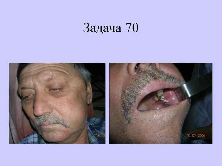 Задача 70 