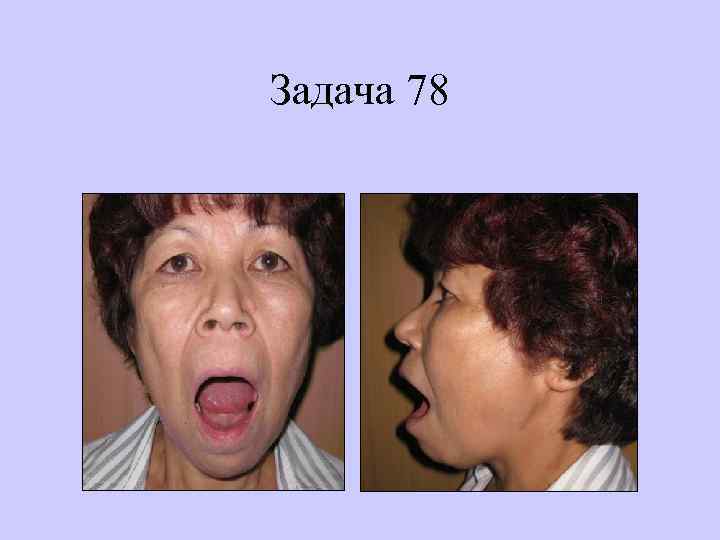 Задача 78 