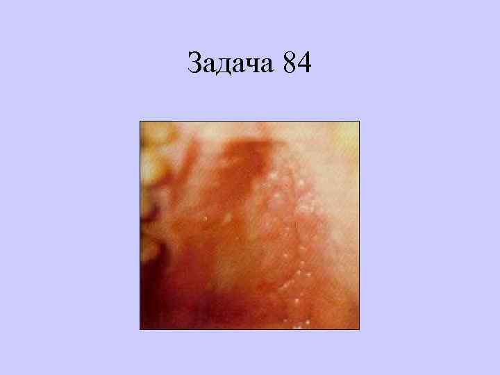 Задача 84 