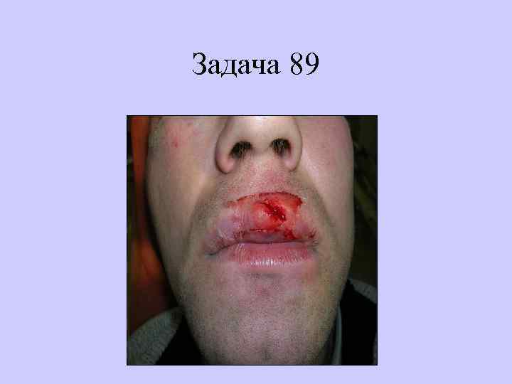 Задача 89 