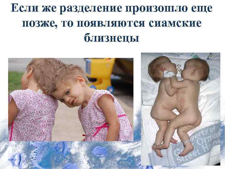 Если же разделение произошло еще позже, то появляются сиамские близнецы 