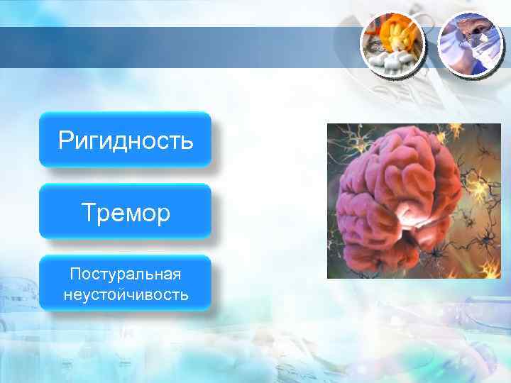 Ригидность Тремор Постуральная неустойчивость 