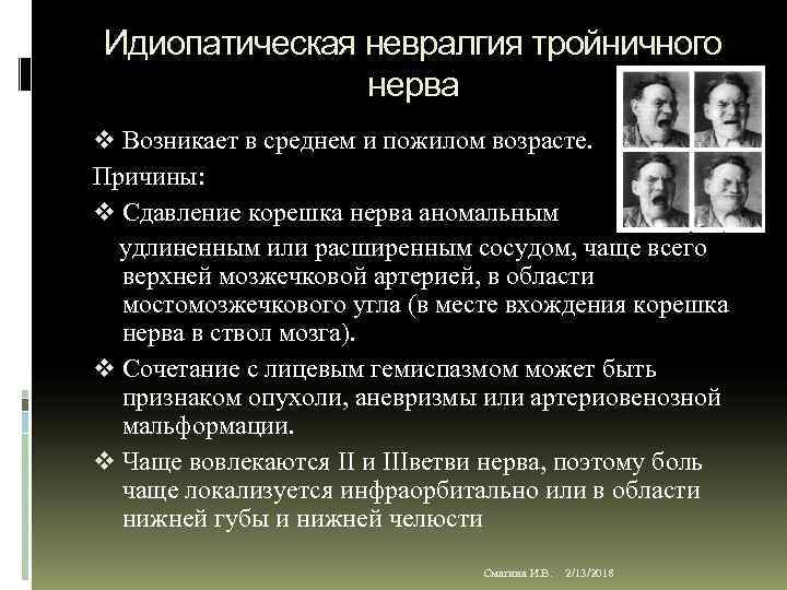 Идиопатическая невралгия тройничного нерва v Возникает в среднем и пожилом возрасте. Причины: v Сдавление