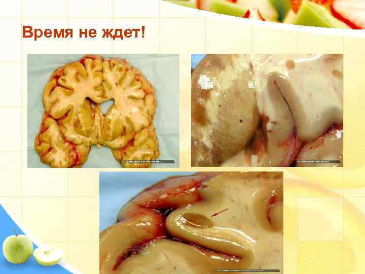 Время не ждет! 