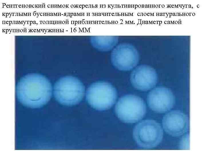 Рентгеновский снимок ожерелья из культивированного жемчуга, с круглыми бусинами-ядрами и значительным слоем натурального перламутра,