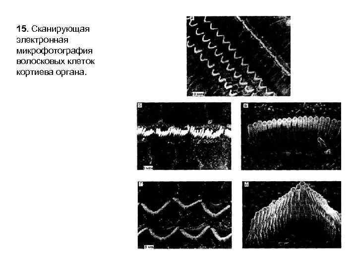 15. Сканирующая электронная микрофотография волосковых клеток кортиева органа. 