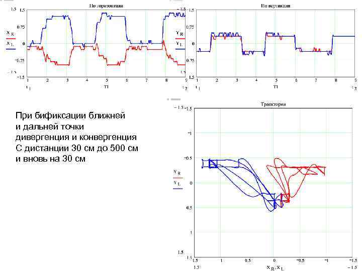 При бификсации ближней и дальней точки дивергенция и конвергенция С дистанции 30 см до