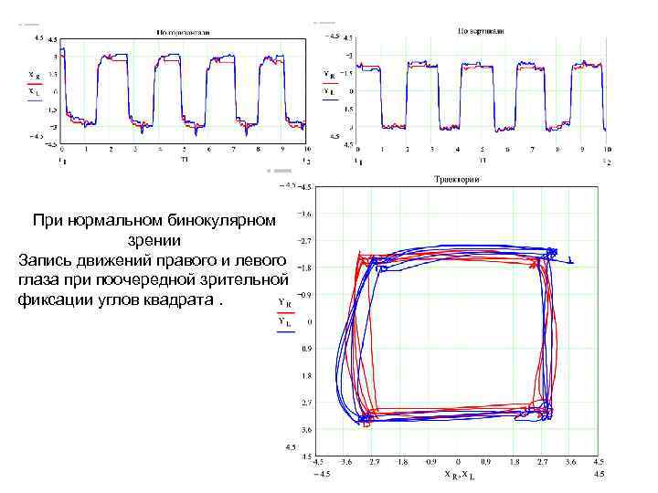 При нормальном бинокулярном зрении Запись движений правого и левого глаза при поочередной зрительной фиксации