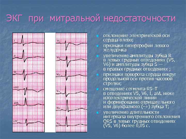 Сердце отклонение эос влево