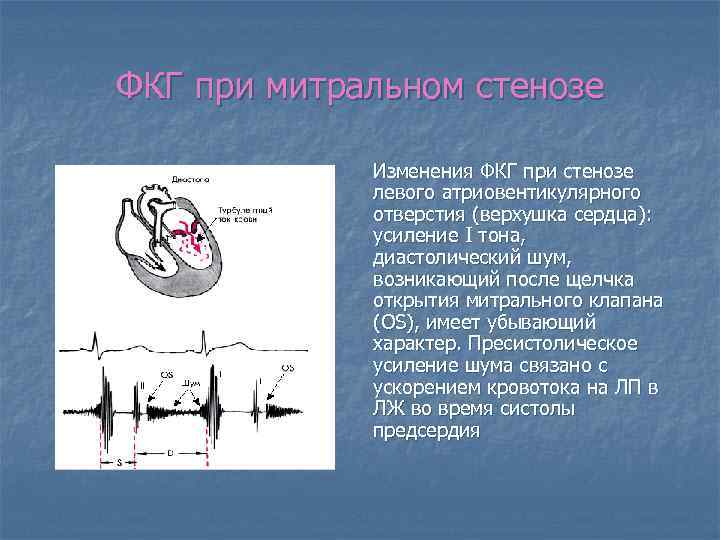 Градиент на митральном клапане