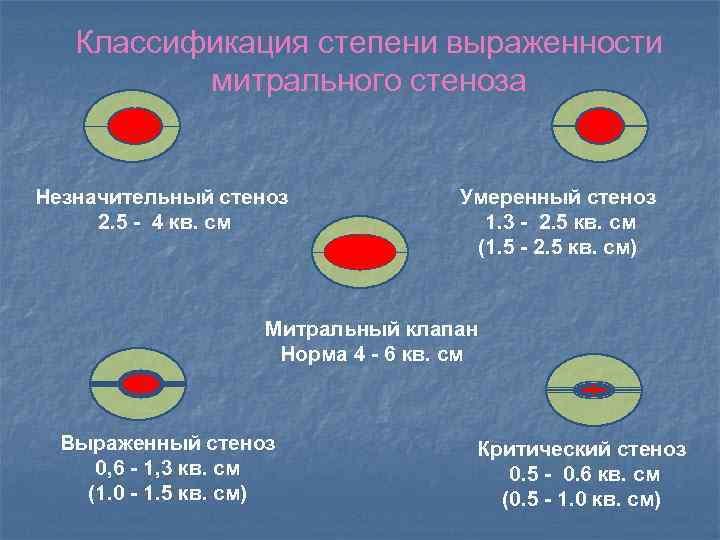 Классификация степени выраженности митрального стеноза Незначительный стеноз 2. 5 - 4 кв. см Умеренный