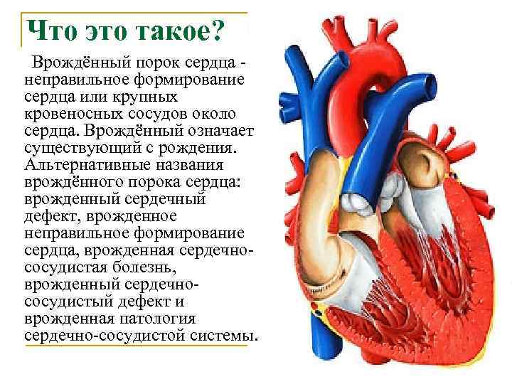 Что это такое? Врождённый порок сердца неправильное формирование сердца или крупных кровеносных сосудов около